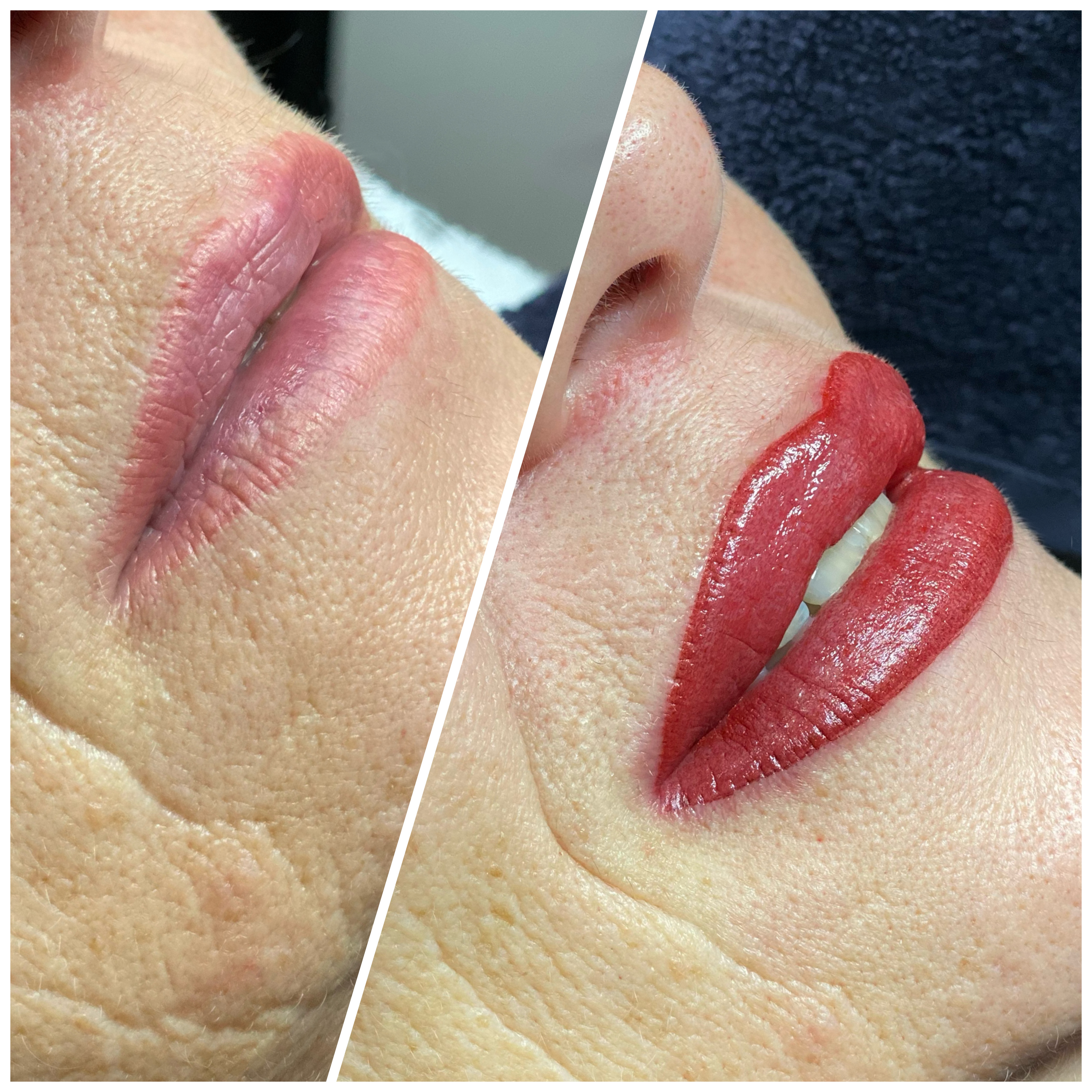 Lippenvollschattierung