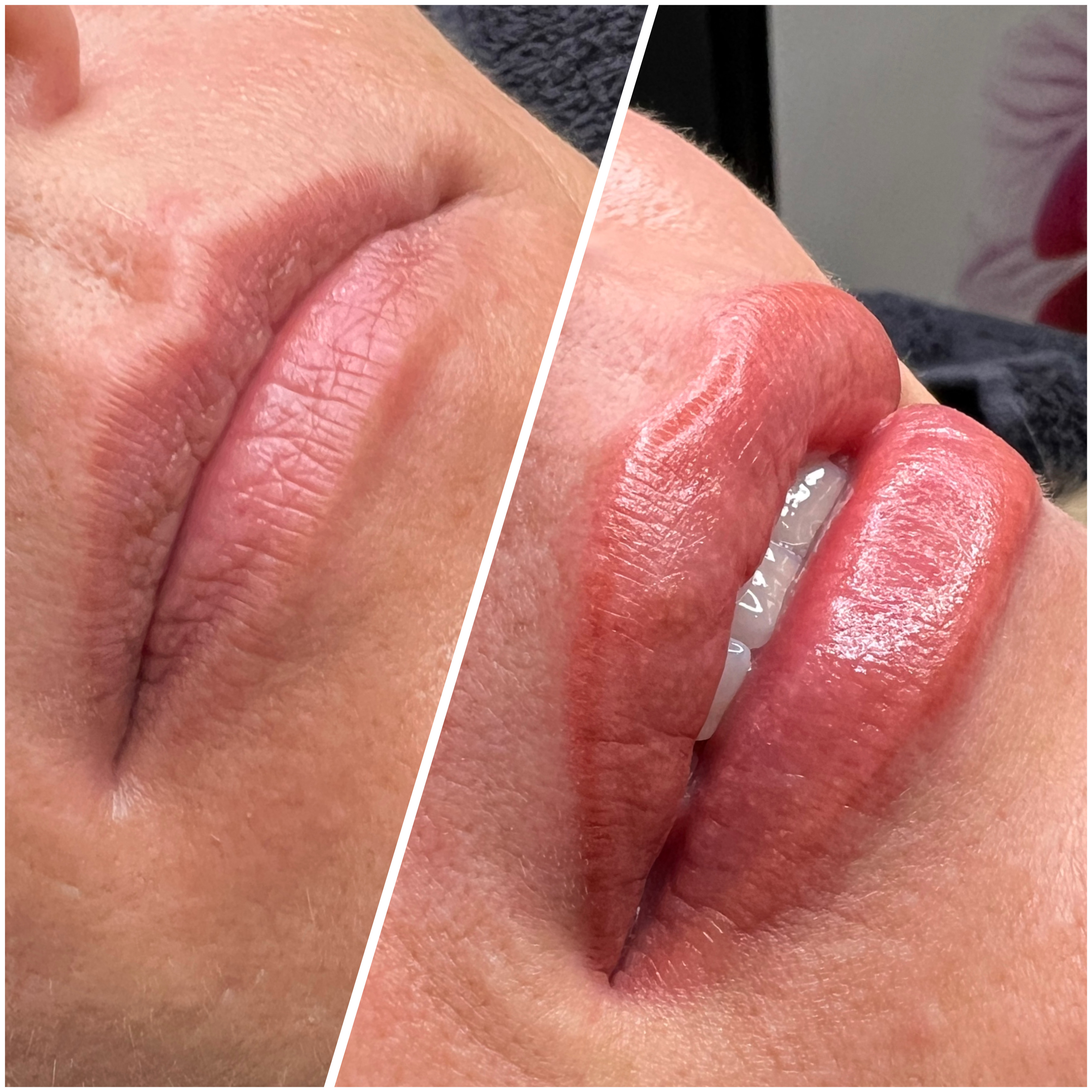 Lippen-Vollschattierung