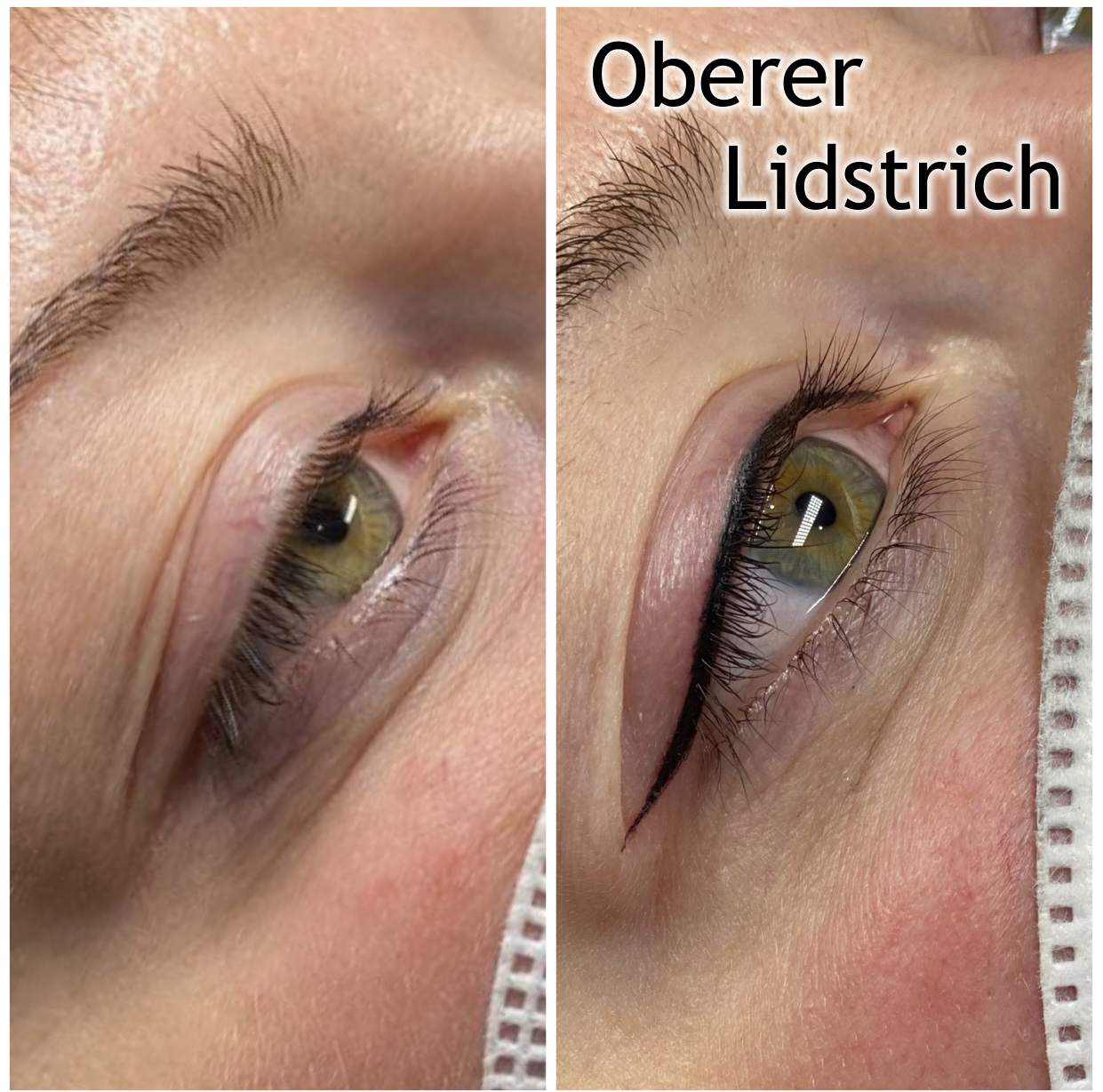 Wimpernkranzverdickung - Lidstrich oben
